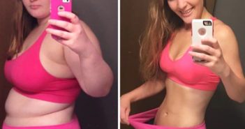 Image result for похудение до и после До и после похудения: фотографии людей, которые невероятно изменились Единственная