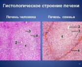 Разрешены клинические испытания печени свиньи, как органа для пересадки человеку