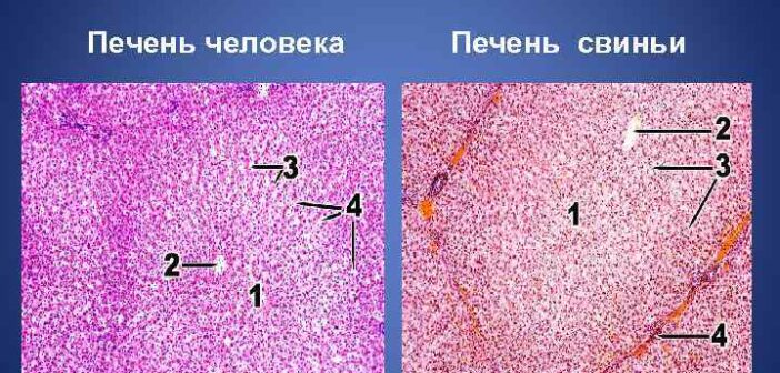 Разрешены клинические испытания печени свиньи, как органа для пересадки человеку