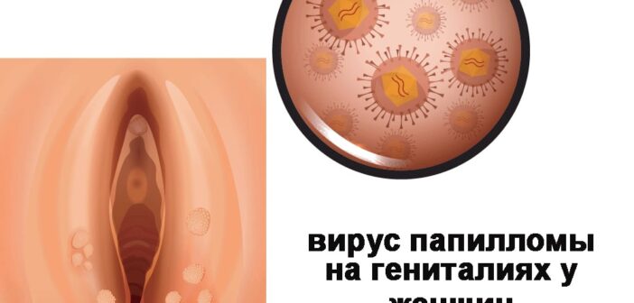 Мужчин в Израиле начал поражать женский половой вирус. Что происходит