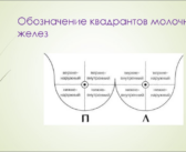 Израильские передовые подходы в терапии метастатического рака молочной железы: новые горизонты и надежды.