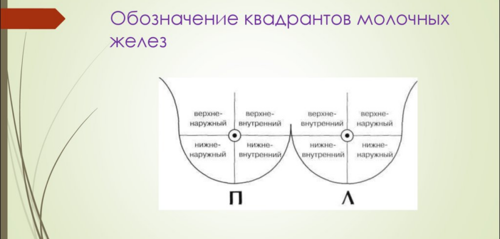 Израильские передовые подходы в терапии метастатического рака молочной железы: новые горизонты и надежды.